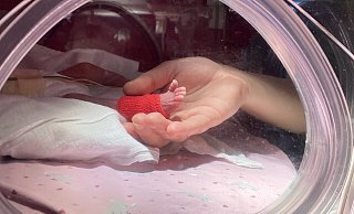 Ein Moment, der zu Herzen geht: Zera Chaer, Mutter der nach 26 Schwangerschaftswochen geborenen Nora, hält durch ein Fenster im Inkubator das Füßchen ihrer Tochter ganz vorsichtig in der Hand. Die Frühgeborene spreizt ihre winzigen Zehen. - Matthias Bungeroth Ein Moment, der zu Herzen geht: Zera Chaer, Mutter der nach 26 Schwangerschaftswochen geborenen Nora, hält durch ein Fenster im Inkubator das Füßchen ihrer Tochter ganz vorsichtig in der Hand. Die Frühgeborene spreizt ihre winzigen Zehen. - Matthias Bungeroth