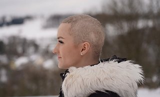 Julia Fischer ist angehende Physiotherapeutin. Sie hat ihr Schicksal angenommen. Ihr Freund Kilian Kunz rasierte ihr die wenig verbliebenden Haare zu einer Glatze. - Privat/Julia Fischer Julia Fischer ist angehende Physiotherapeutin. Sie hat ihr Schicksal angenommen. Ihr Freund Kilian Kunz rasierte ihr die wenig verbliebenden Haare zu einer Glatze. - Privat/Julia Fischer