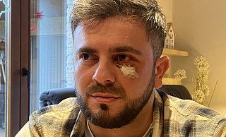 Schwer gezeichnet ist der aus Georgien stammende Mndia Thünker nach der Attacke in einer Harsewinkeler Disko. - Burkhard Hoeltzenbein Schwer gezeichnet ist der aus Georgien stammende Mndia Thünker nach der Attacke in einer Harsewinkeler Disko. - Burkhard Hoeltzenbein