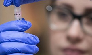 Auswertung eines Coronatests. - Symbolfoto: Pixabay Auswertung eines Coronatests. - Symbolfoto: Pixabay