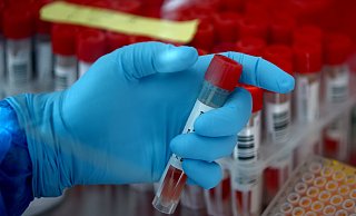 Zweifel an der Gültigkeit einer unbekannten Zahl von PCR-Testergebnissen müssen unbedingt ausgeräumt werden. - LISI NIESNER Zweifel an der Gültigkeit einer unbekannten Zahl von PCR-Testergebnissen müssen unbedingt ausgeräumt werden. - LISI NIESNER