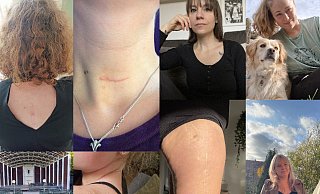Die Narben offen zeigen, ihre Geschichten erzählen, zu ihnen stehen. All das ist nicht immer einfach. - Zoé Zacharias Die Narben offen zeigen, ihre Geschichten erzählen, zu ihnen stehen. All das ist nicht immer einfach. - Zoé Zacharias
