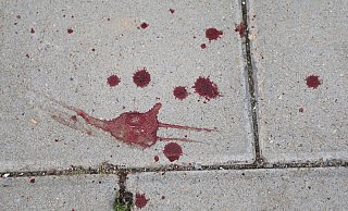 Die Frau auf dem Gehweg war verletzt, konnte sich aber an nichts mehr erinnern. - Symbolfoto: picture alliance/dpa Die Frau auf dem Gehweg war verletzt, konnte sich aber an nichts mehr erinnern. - Symbolfoto: picture alliance/dpa