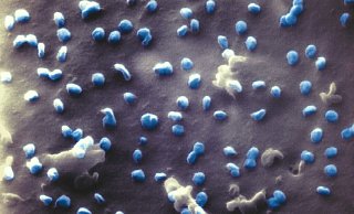 Die Coronaviren an der Affenzelle, blau eingefärbt. - Uni Bielefeld Die Coronaviren an der Affenzelle, blau eingefärbt. - Uni Bielefeld