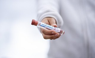 Wieviele Corona-Test wurden im Kreis Höxter bereits durchgeführt? Diese Frage kann niemand beantworten. - Pixabay Wieviele Corona-Test wurden im Kreis Höxter bereits durchgeführt? Diese Frage kann niemand beantworten. - Pixabay