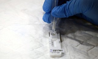 Das Prinzip des Antigen-Schnelltest ähnelt dem eines Schwangerschaftstests. - Reuters/ Sergio Perez Das Prinzip des Antigen-Schnelltest ähnelt dem eines Schwangerschaftstests. - Reuters/ Sergio Perez