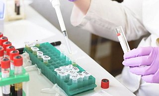 Ab sofort werden nicht mehr alle Neuinfektionen auf Mutationen überprüft. Damit sollen auch die Labore entlastet werden. - Symbolfoto: Pixabay Ab sofort werden nicht mehr alle Neuinfektionen auf Mutationen überprüft. Damit sollen auch die Labore entlastet werden. - Symbolfoto: Pixabay