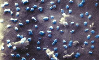 Coronaviren (blau) beim Austritt aus einer Nierenzelle, aufgenommen mit einem Heliumionen-Mikroskop. - Foto: Natalie Frese/Universität Bielefeld/dpa Coronaviren (blau) beim Austritt aus einer Nierenzelle, aufgenommen mit einem Heliumionen-Mikroskop. - Foto: Natalie Frese/Universität Bielefeld/dpa