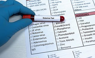 Im Kreis Paderborn hat es im ersten Halbjahr 2025 bereits 76 Rotavirus-Infektionen gegeben. - AOK/Colourbox/hfr Im Kreis Paderborn hat es im ersten Halbjahr 2025 bereits 76 Rotavirus-Infektionen gegeben. - AOK/Colourbox/hfr