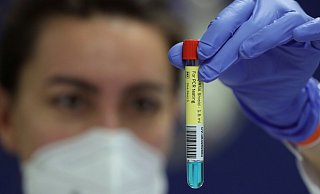 Ein PCR-Test darf vor Anpfiff nicht älter als 48 Stunden sein. Foto: Reuters - REUTERS Ein PCR-Test darf vor Anpfiff nicht älter als 48 Stunden sein. Foto: Reuters - REUTERS