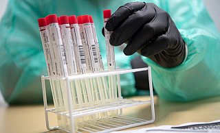 Jede Patientin und jeden Patienten wird im Johannesstift vor der stationären Aufnahme mit einem PCR-Test getestet. - Sina Schuldt Jede Patientin und jeden Patienten wird im Johannesstift vor der stationären Aufnahme mit einem PCR-Test getestet. - Sina Schuldt