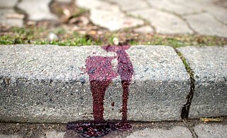 Das schwer verletzte Opfer konnte keine Aussage mehr zu der Attacke machen. - Verwendung weltweit Das schwer verletzte Opfer konnte keine Aussage mehr zu der Attacke machen. - Verwendung weltweit