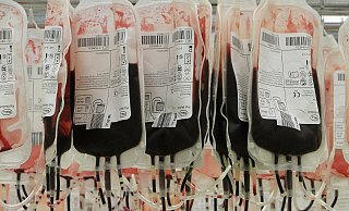 Weniger Menschen spenden Blut. Die Produkte sind so knapp, dass das Auswirkungen auf die Kliniken haben kann. - Susanne Barth Weniger Menschen spenden Blut. Die Produkte sind so knapp, dass das Auswirkungen auf die Kliniken haben kann. - Susanne Barth