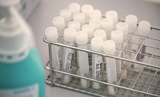 Patienten, die im Krankenhaus stationär verbleiben, erhalten weiter einen PCR-Test. - Thorsten Ulonska Patienten, die im Krankenhaus stationär verbleiben, erhalten weiter einen PCR-Test. - Thorsten Ulonska