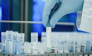 PCR-Tests sind zwar sehr aussagekräftig, werden aber immer seltener durchgeführt. - Uwe Anspach PCR-Tests sind zwar sehr aussagekräftig, werden aber immer seltener durchgeführt. - Uwe Anspach