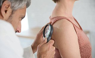 Die gesetzlichen Krankenkassen empfehlen und finanzieren Männern und Frauen alle zwei Jahre ein Hautscreening zur Früherkennung von Hautkrebs. - picture alliance Die gesetzlichen Krankenkassen empfehlen und finanzieren Männern und Frauen alle zwei Jahre ein Hautscreening zur Früherkennung von Hautkrebs. - picture alliance