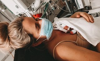 Hautkontakt zu den Eltern ist auch für Frühchen lebenswichtig. Hier liegt Ella kurz nach der Geburt auf dem Bauch ihrer Mutter Janina. - privat Hautkontakt zu den Eltern ist auch für Frühchen lebenswichtig. Hier liegt Ella kurz nach der Geburt auf dem Bauch ihrer Mutter Janina. - privat