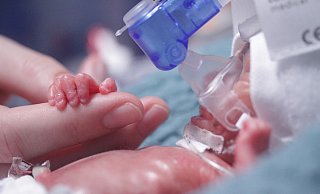 Sam wog bei seiner Geburt am 11. November 2022 nur 305 Gramm. - St.-Vincenz-Kliniken Sam wog bei seiner Geburt am 11. November 2022 nur 305 Gramm. - St.-Vincenz-Kliniken