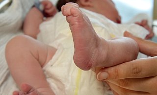 Werdende Mütter müssen sich seit der Schließung der Geburtsstation Melle nach Alternativen umschauen. Hebammengeleitete Kreißsäle gewinnen in den umliegenden Kliniken zunehmend an Relevanz. - Waltraud Grubitzsch/dpa Werdende Mütter müssen sich seit der Schließung der Geburtsstation Melle nach Alternativen umschauen. Hebammengeleitete Kreißsäle gewinnen in den umliegenden Kliniken zunehmend an Relevanz. - Waltraud Grubitzsch/dpa