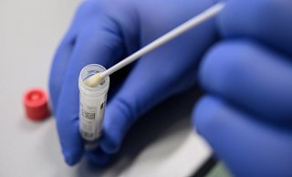 Ein Abstrich für das Testverfahren auf das Virus SARS-CoV-2. - picture alliance Ein Abstrich für das Testverfahren auf das Virus SARS-CoV-2. - picture alliance