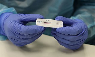So sieht ein Schnelltest aus. Wird Sars-CoV-2 nachgewiesen, erscheinen zwei Striche. - David Knapp So sieht ein Schnelltest aus. Wird Sars-CoV-2 nachgewiesen, erscheinen zwei Striche. - David Knapp