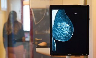 Mammographie-Screening: Zwischen dem 50. und 70. Lebensjahr werden Frauen alle zwei Jahre zur Brustkrebsvorsorge eingeladen. - picture alliance Mammographie-Screening: Zwischen dem 50. und 70. Lebensjahr werden Frauen alle zwei Jahre zur Brustkrebsvorsorge eingeladen. - picture alliance