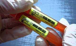 In der Stadt könnten mehr Corona-Tests durchgeführt werden. - picture alliance / SvenSimon In der Stadt könnten mehr Corona-Tests durchgeführt werden. - picture alliance / SvenSimon