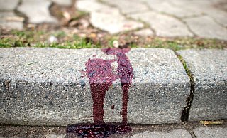 Der 32-jährige Bielefelder wurde laut Polizeibericht grundlos angegriffen. - picture alliance / Hauke-Christi Der 32-jährige Bielefelder wurde laut Polizeibericht grundlos angegriffen. - picture alliance / Hauke-Christi