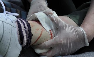 Entgegen der Darstellung der Mutter kam es laut Polizei nicht zu einem Zusammenstoß. Trotzdem verletzte sich das Mädchen leicht. - picture alliance Entgegen der Darstellung der Mutter kam es laut Polizei nicht zu einem Zusammenstoß. Trotzdem verletzte sich das Mädchen leicht. - picture alliance