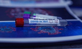 Das Gesundheitsamt kann nicht sagen, wie viel getestet wird. - Symbolfoto: Pixabay Das Gesundheitsamt kann nicht sagen, wie viel getestet wird. - Symbolfoto: Pixabay